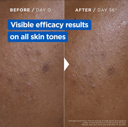 Mixa Niacinamide Bright Moisturizing Anti-Dark Spot Cream Jar