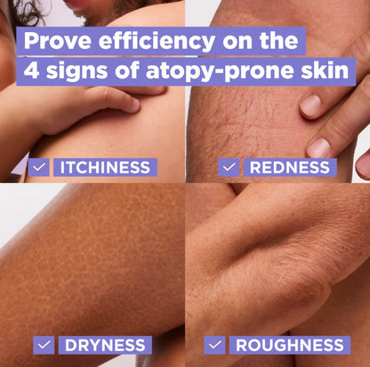 Mixa Panthenol Comfort Face, Hands, & Body Anti-Scratching Cream For Dry Skin, Atopy Prone Skin and Eczema 400ml