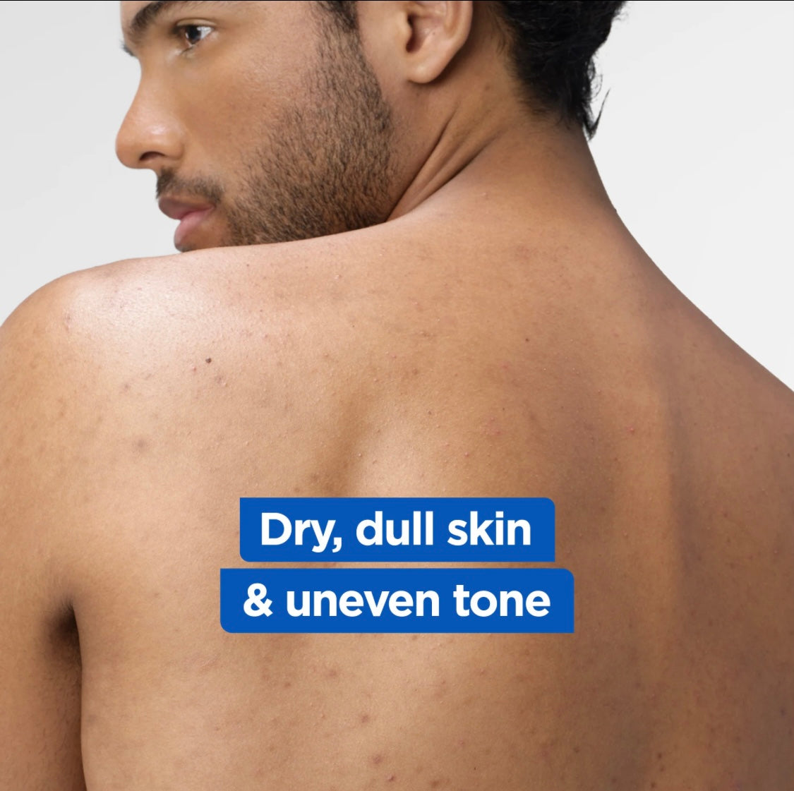 Mixa Niacinamide Bright Body Lotion for Dry & Dull Skin