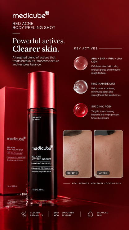 Medicube Red Acne Body Peeling Shot | Clear Back & Body Acne Fast