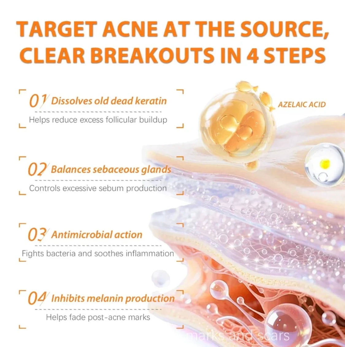 Skinoren 20% Azaleic Acid Cream