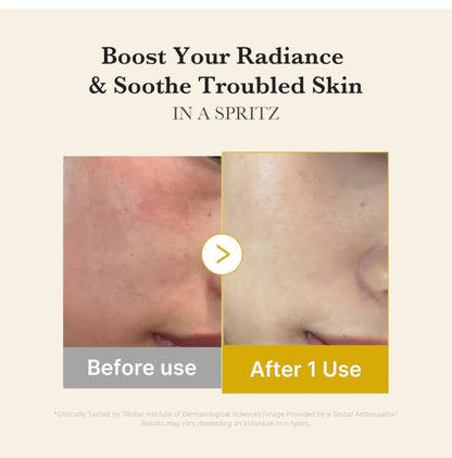 Kojic Acid Tumeric Vita Jelly Mist