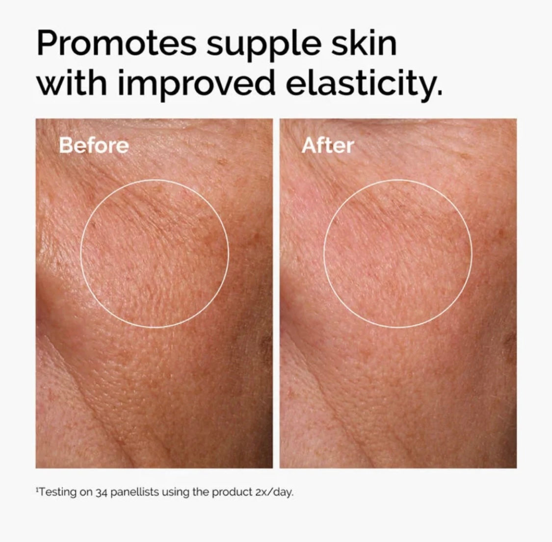 The Ordinary Hyaluronic Acid 2% + B5 (with Ceramides) – Deep Hydration & Barrier Support Serum