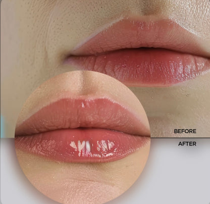 Revox B77 Just Lip Filler – Hydrating & Volume-Boosting Lip Plumping Serum