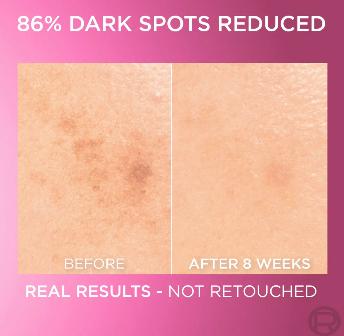 L’Oréal Paris Glycolic Bright Face Serum with 8% Melasyl + Glycolic Acid+ Niacinamide for Dark spots darkening