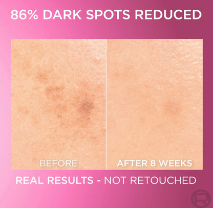 L’Oréal Paris Glycolic Bright Face Serum with 8% Melasyl + Glycolic Acid+ Niacinamide for Dark spots darkening