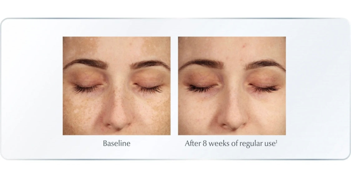 Eucerin Even Pigment Perfector Dual Serum | Thiamidol Dark Spot Corrector & Brightening Serum