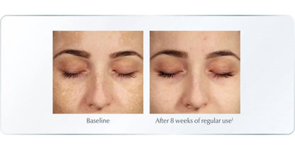 Eucerin Even Pigment Perfector Dual Serum | Thiamidol Dark Spot Corrector & Brightening Serum