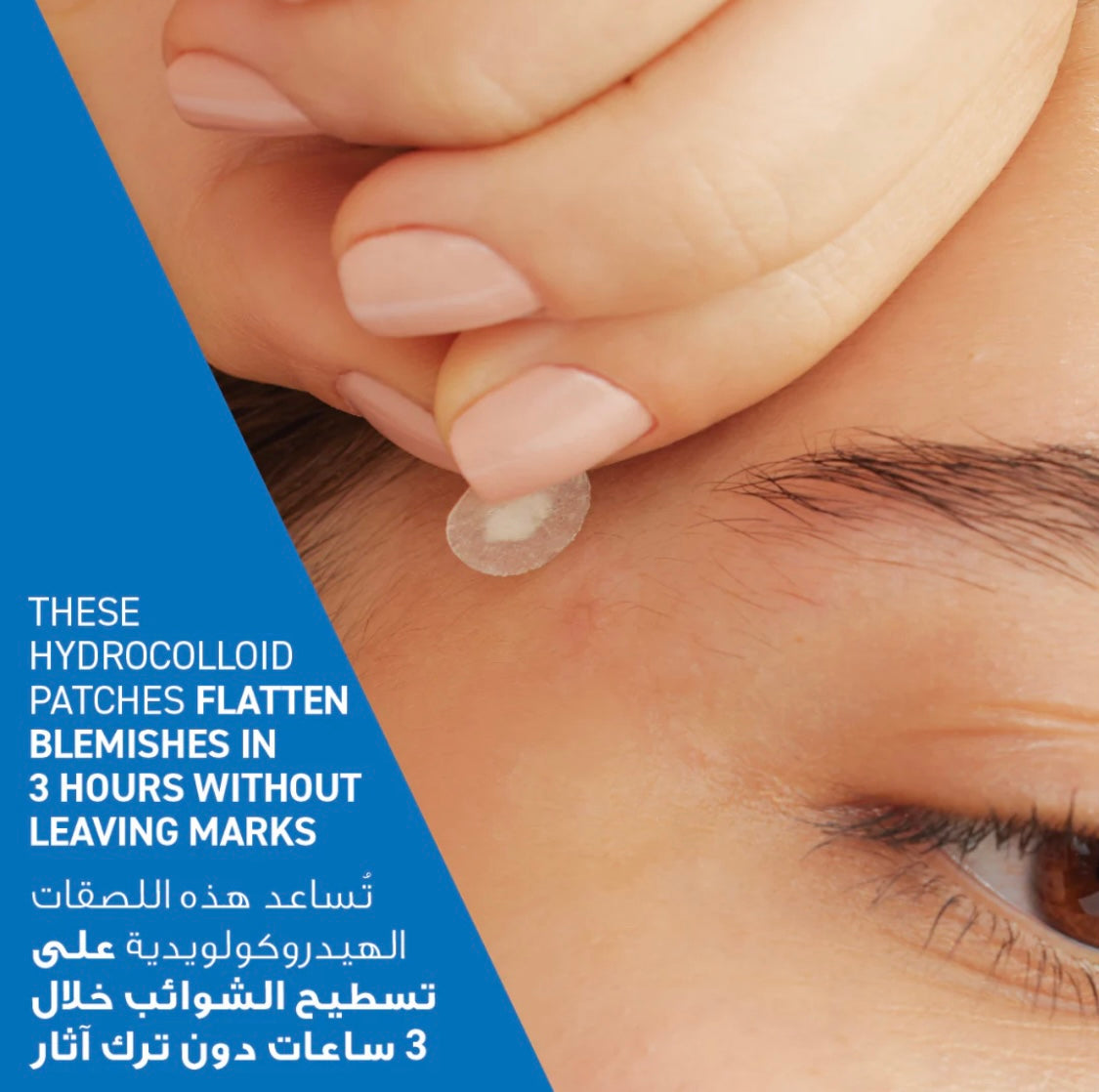 CeraVe Acne Control Pimple Patches – Hydrocolloid Blemish Spots with Essential Ceramides