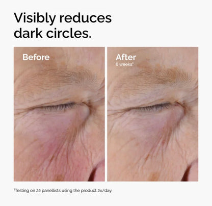 The Ordinary Caffeine Solution 5% + EGCG – Depuffing & Dark Circle Eye Serum