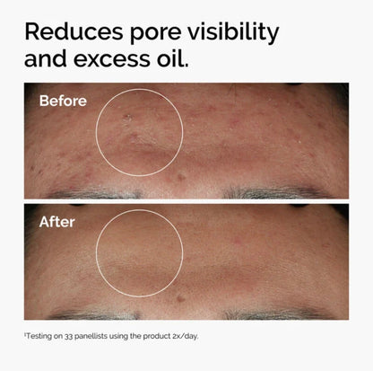 The Ordinary Niacinamide 10% +Zn 1% Hydrating and Oil Control Serum for Oily Skin