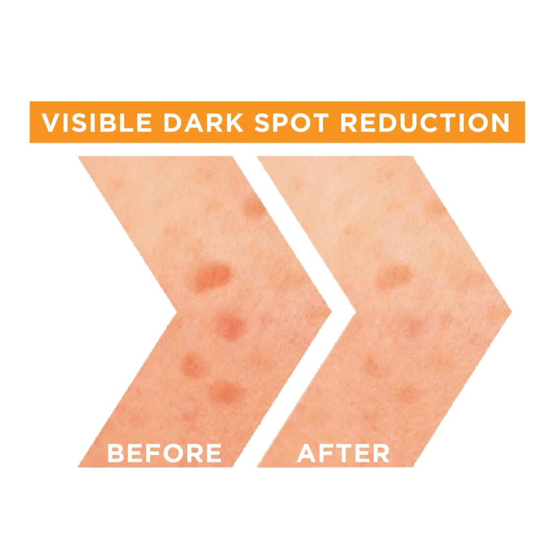 Garnier SkinActive Fast Bright Vitamin C + Niacinamide 30x Brightening Booster Serum – Dark Spot Corrector & Radiance Booster