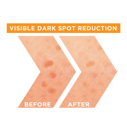 Garnier SkinActive Fast Bright Vitamin C + Niacinamide 30x Brightening Booster Serum – Dark Spot Corrector & Radiance Booster