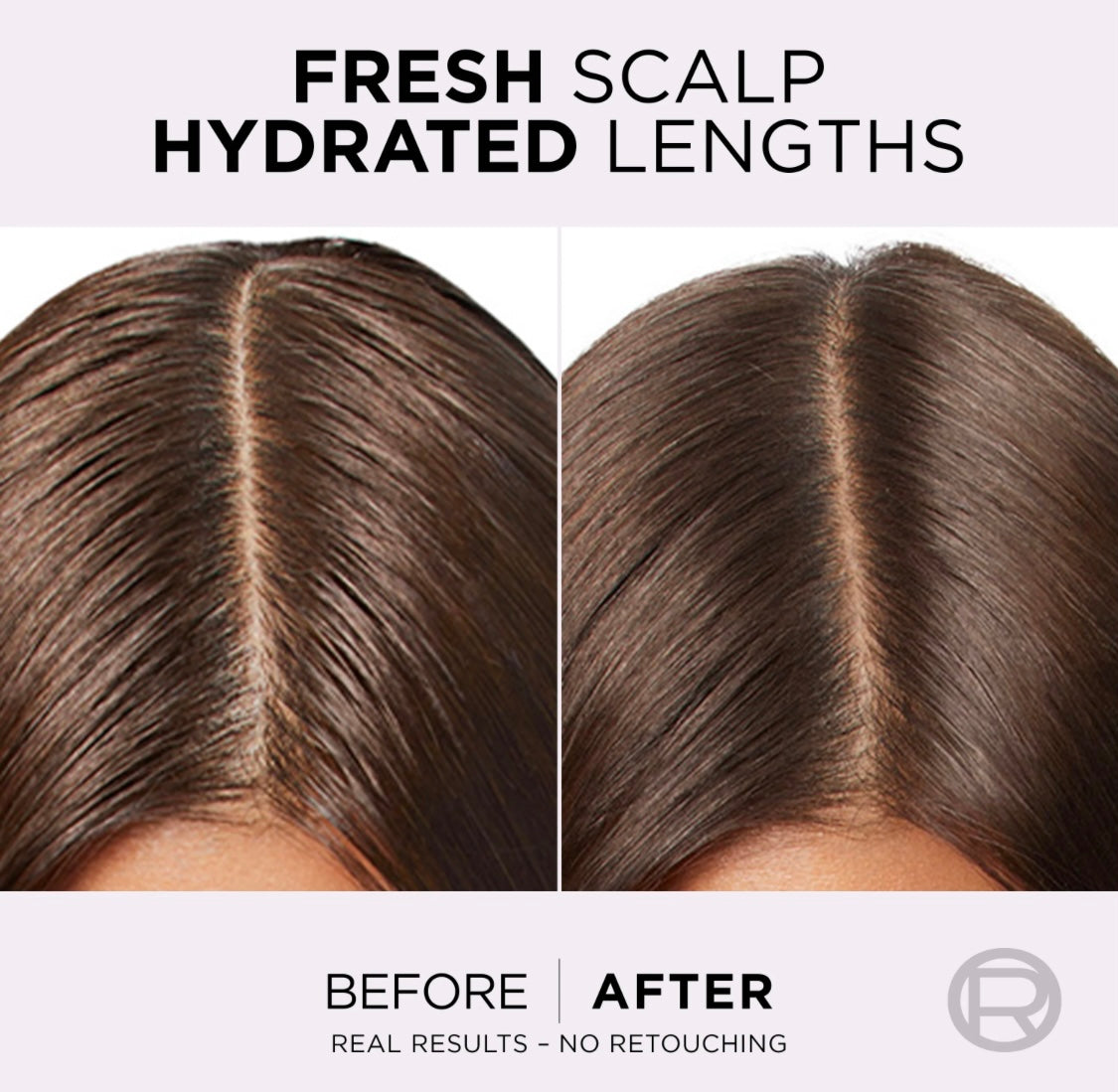 L’Oréal Paris Elvive Hyaluron Pure Serum 102ml