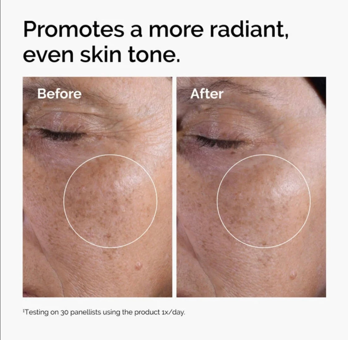 The Ordinary Glycolic Acid 7% Exfoliating Toner – Brightening & Smoothing Solution