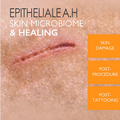 A-Derma Epitheliale A.H Ultra Anti-Mark Ultra Repairing Cream- Buy 1 get 1 for Free