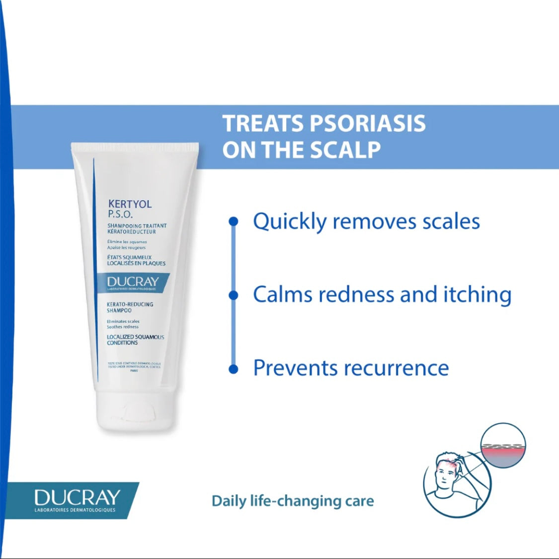 Ducray Keratoyl - Psoriasis Kerato Reducing Shampoo -200ml