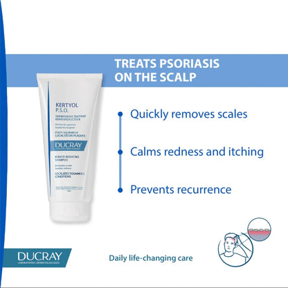 Ducray Keratoyl - Psoriasis Kerato Reducing Shampoo -200ml
