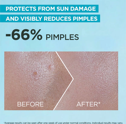 Garnier Super UV Anti-Acne Sunscreen SPF 50 30ml – 12H Oil Control Face Sunscreen for Oily & Acne-Prone Skin