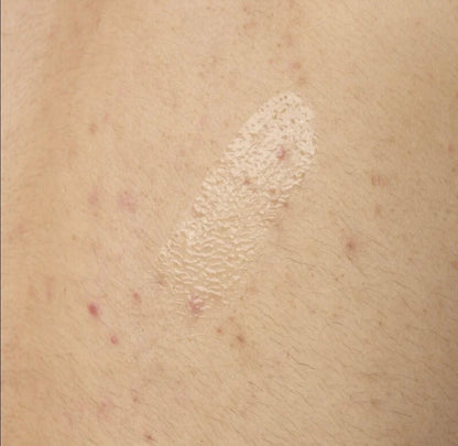 The Ordinary Salicylic Acid 0.5% Body Serum – Exfoliating Acne Treatment for Body & Back