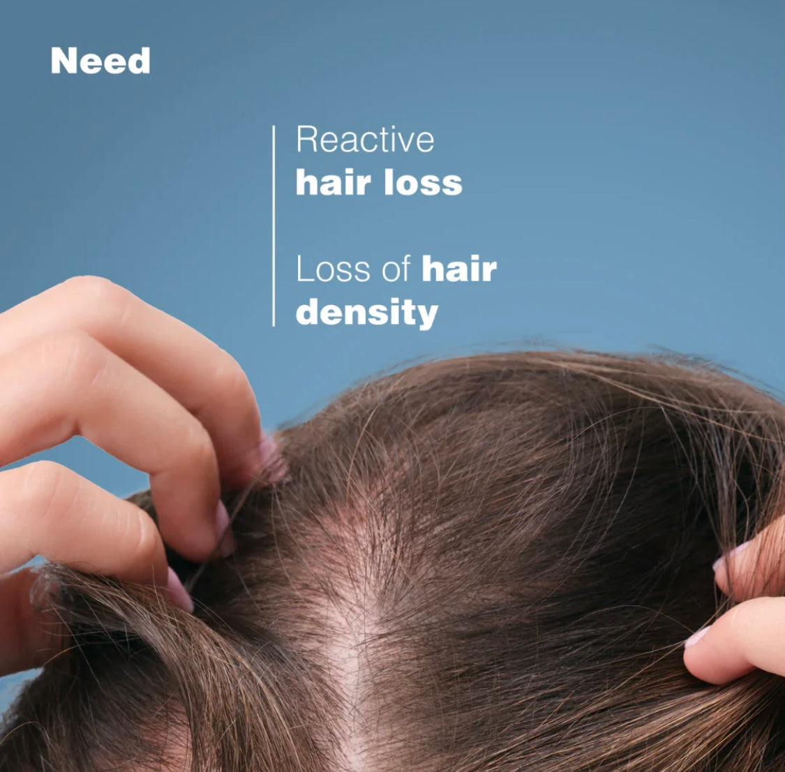 Ducray Anaphase Plus Anti-Hair Loss Compliment Shampoo