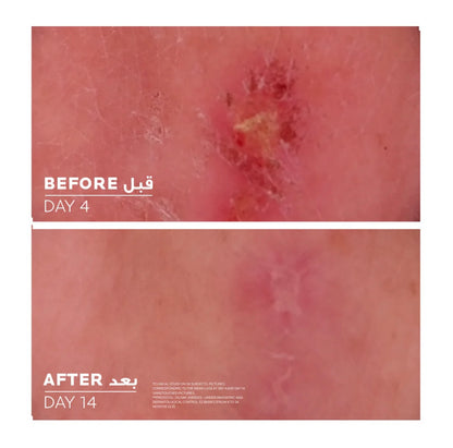 La Roche Posay Cicaplast Baume B5