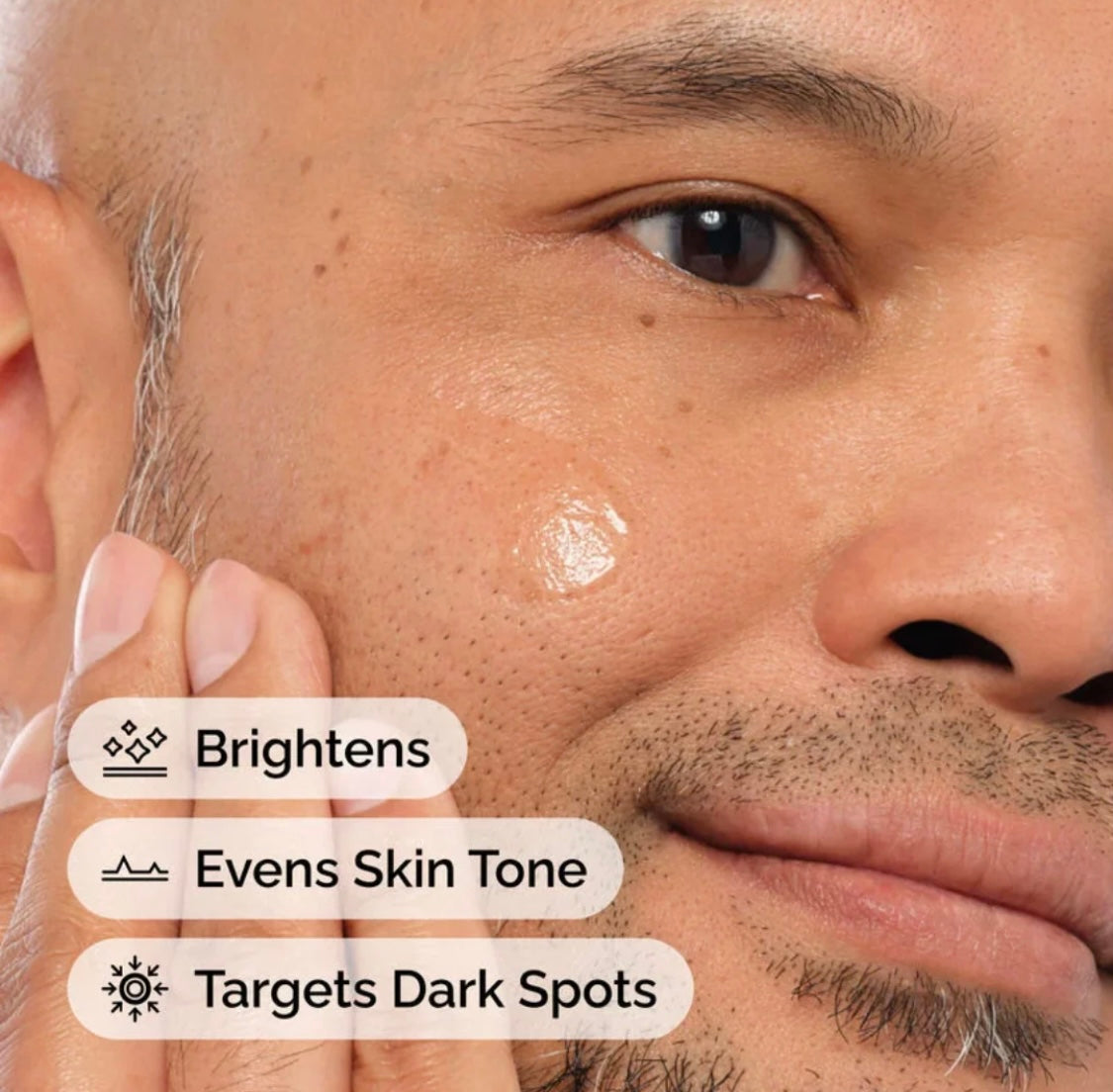 The Ordinary Alpha Arbutin 2% + Hyaluronic Acid Serum – Dark Spots & Hyperpigmentation Treatment